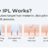IPL Hair Removal Device 999999 Flashes  Permanent Epilator Body Treament Home Use for Women Men Facial Shaver Cutting Machine - Imagen 12